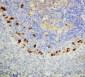 Anti-SOCS1 Antibody